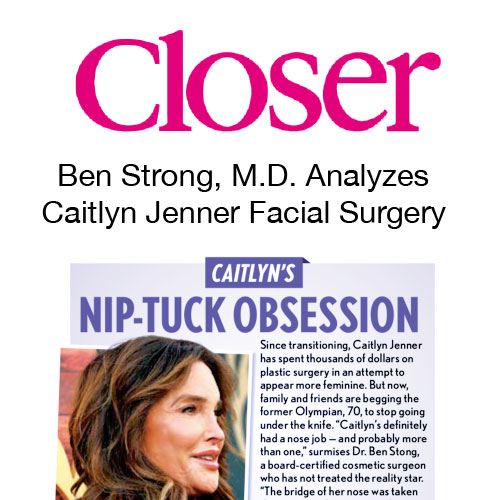 Screenshot of article in Closer: Ben Strong, M.D. Analyzes Caitlyn Jenner Facial Surgery